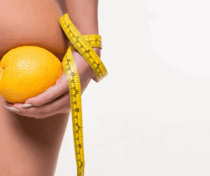 cellulite